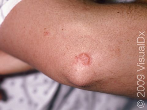 RED RASHES ON THE SKIN? READ THIS INFORMATIVE DEEP-DIVE | Mya Care