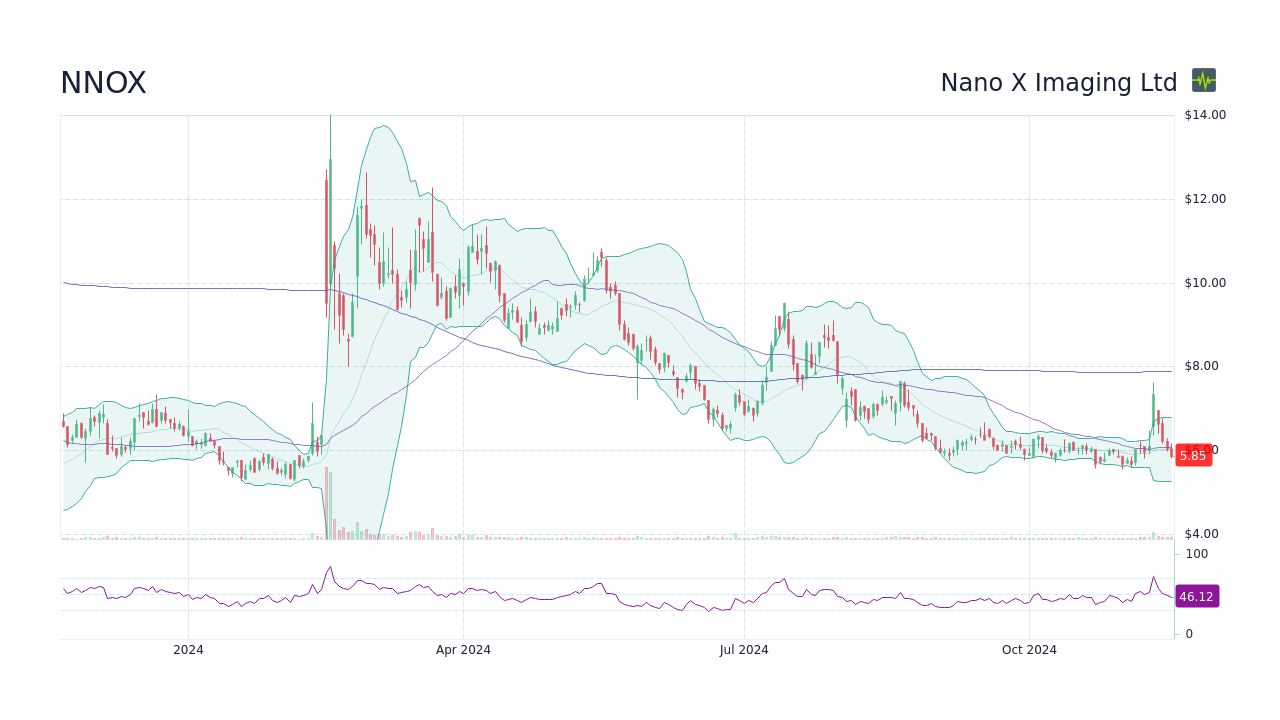 NNOX - Nano X Imaging Ltd Stock Price Forecast , , to - StockScan